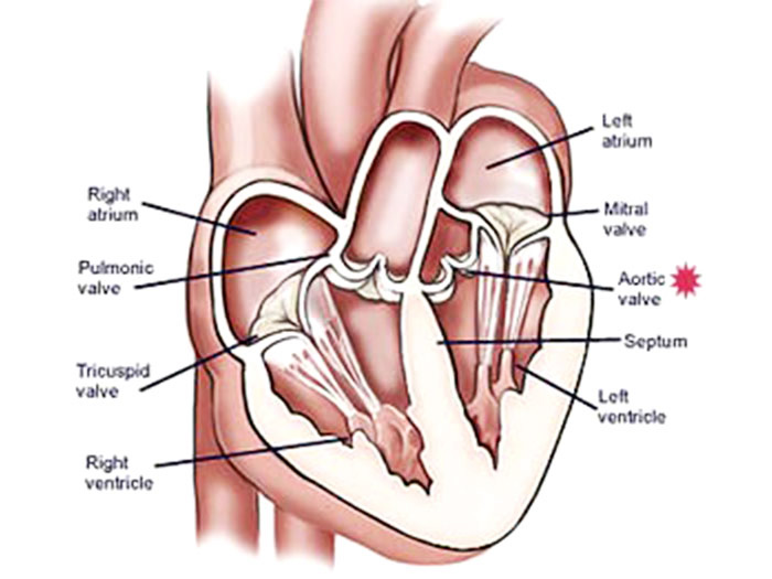 Heart Valve Surgery in Mumbai